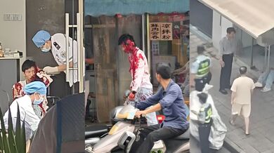 广西柳州柳北大润发 精神小伙斗殴持刀砍头皮事件 受害者头部中刀头皮掀起 血腥程度极高！